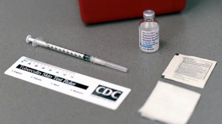 Image of items used in a tuberculosis test.